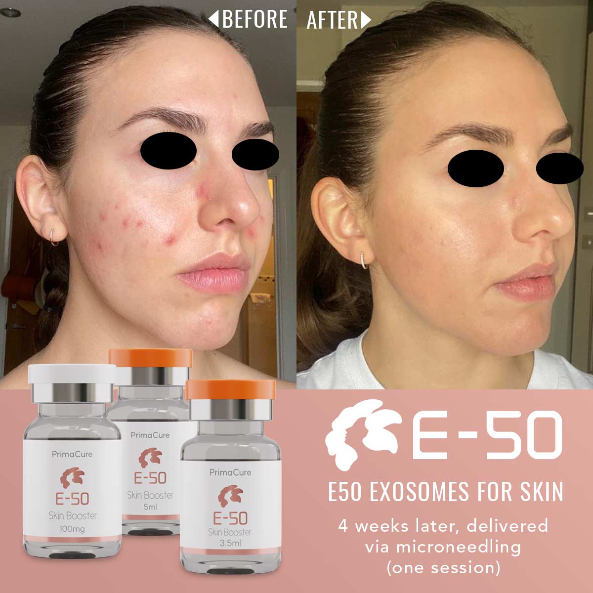 E50-Exosomes for Skin