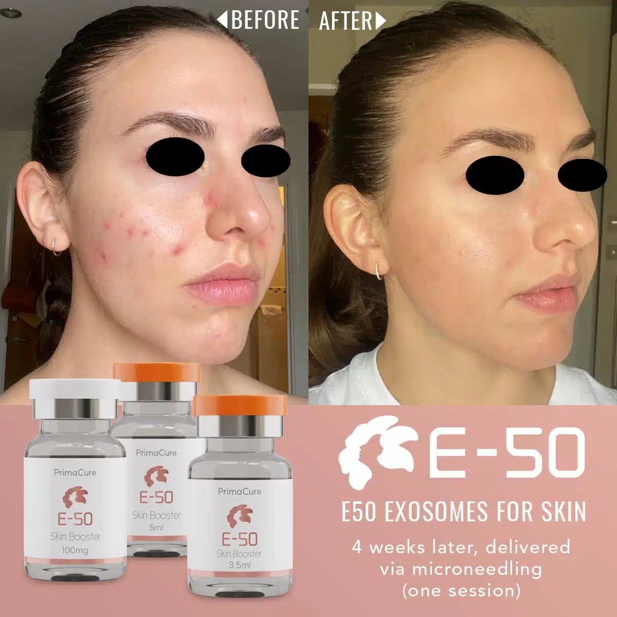 E50-Exosomes for Skin E50-Exosomes for Skin