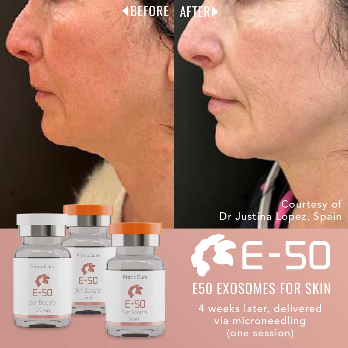 E50-Skin Rejuvenation Exosomes