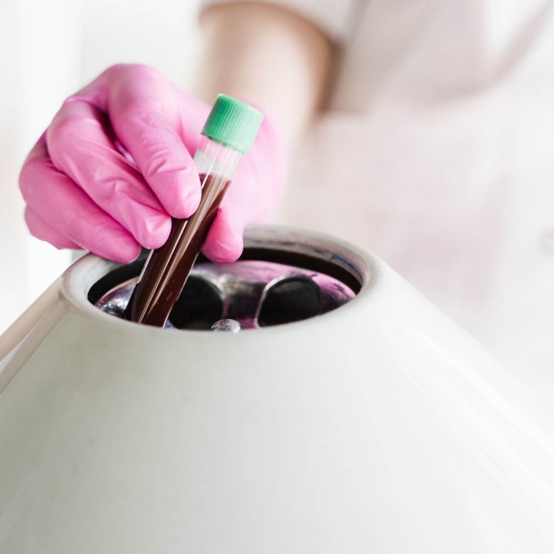 PRP Centrifuge PRP Centrifuge