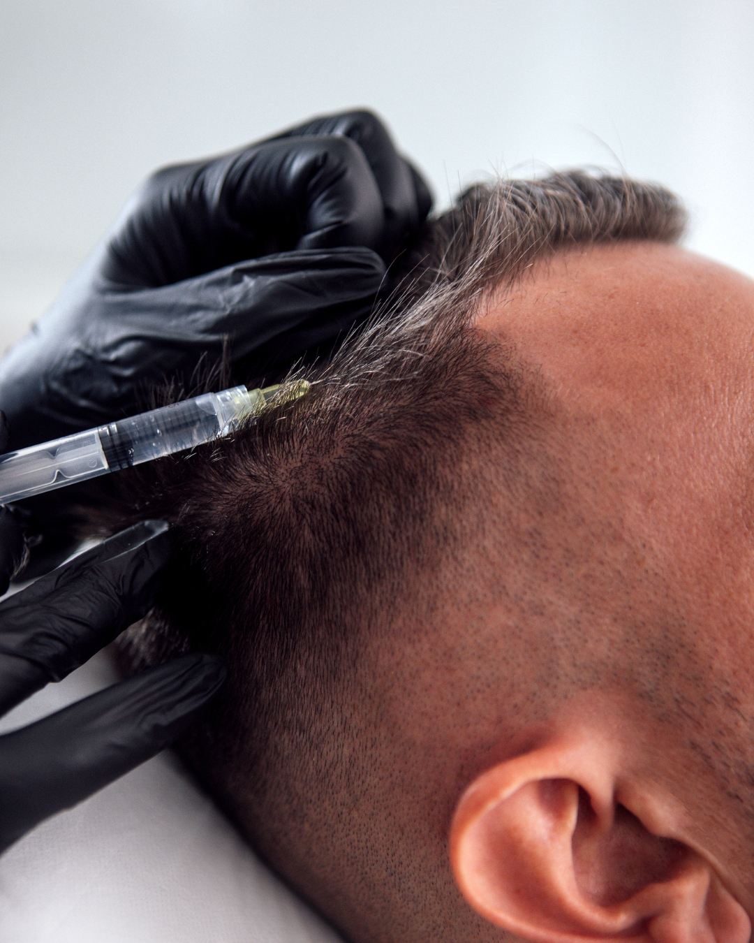 Polynucleotides for Hair in Hastings