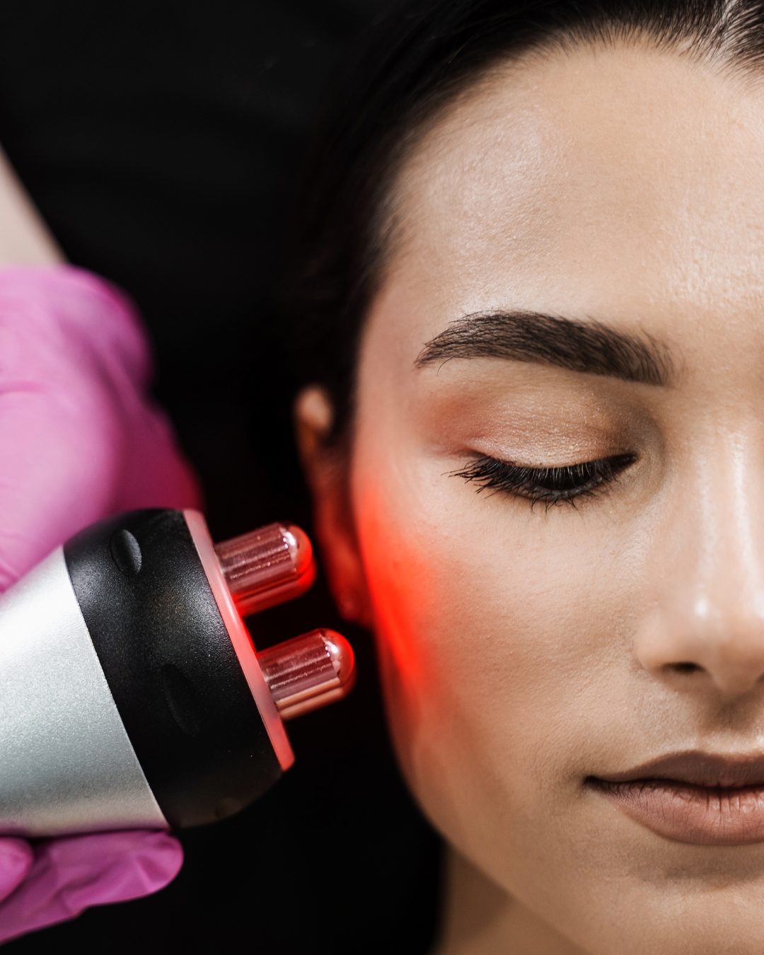 Radiofrequency Facial Hastings Radiofrequency Facial Hastings