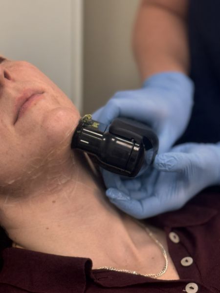 HIFU Treatment Hastings