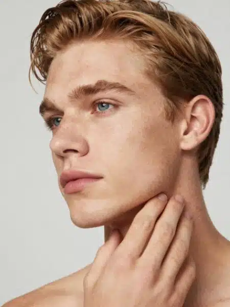 Jawline Filler Hastings