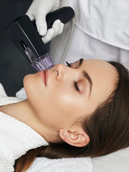 Radiofrequency Facial